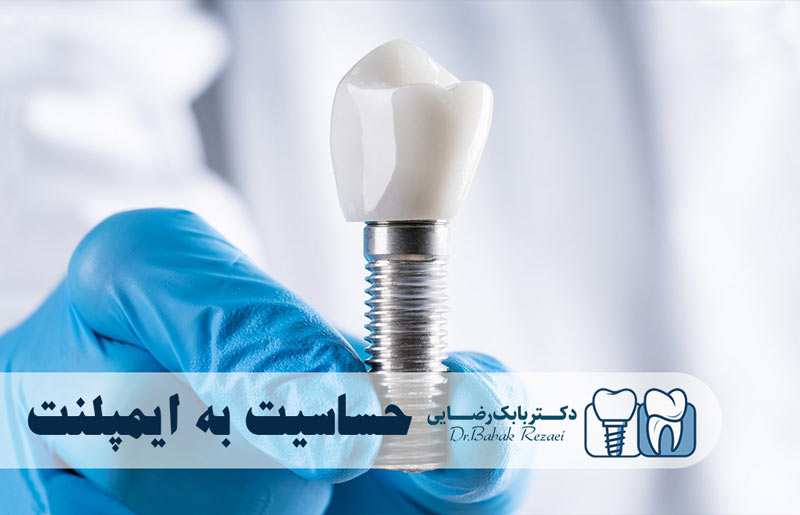 حساسیت به ایمپلنت دندان