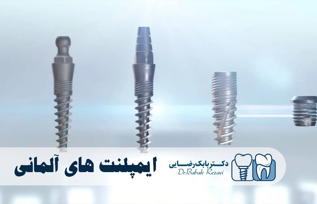 ایمپلنت آلمانی