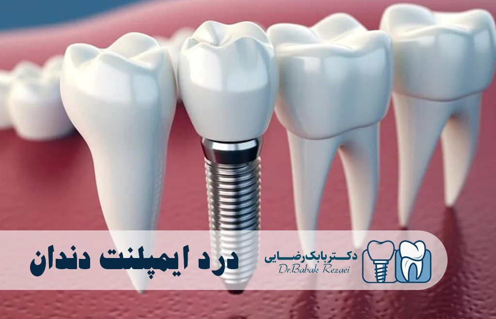 درد ایمپلنت دندان چقدر است