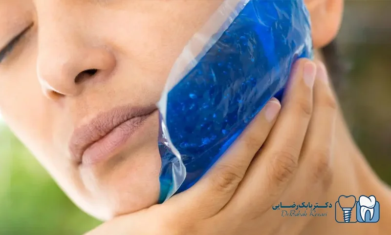 روش های تسکین و کاهش ورم ایمپلنت