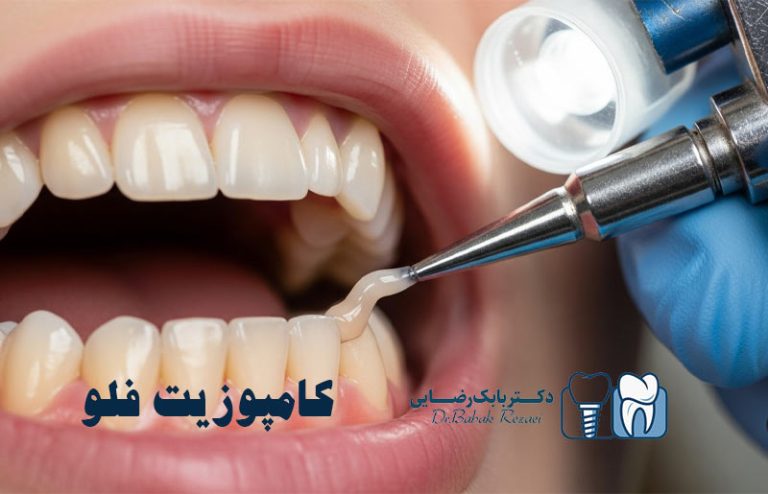 کامپوزیت فلو