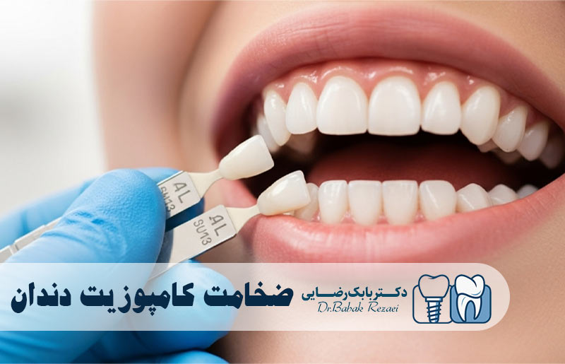 ضخامت کامپوزیت دندان