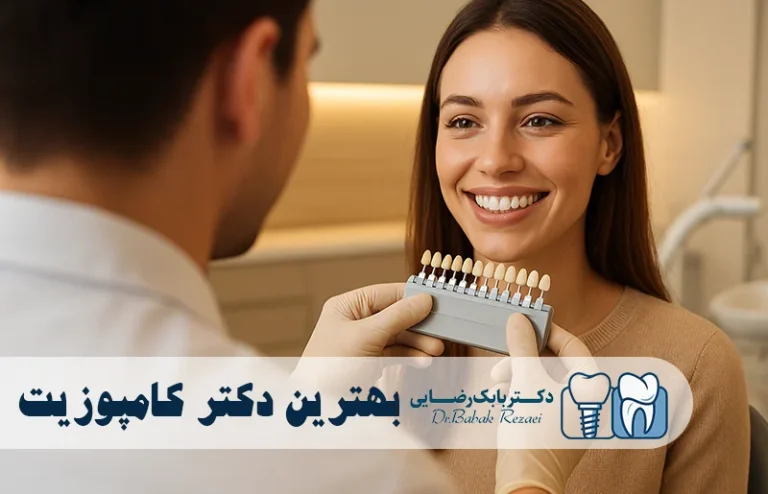 بهترین دکتر کامپوزیت دندان در تهران