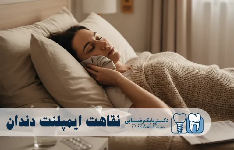 نقاهت ایمپلنت دندان