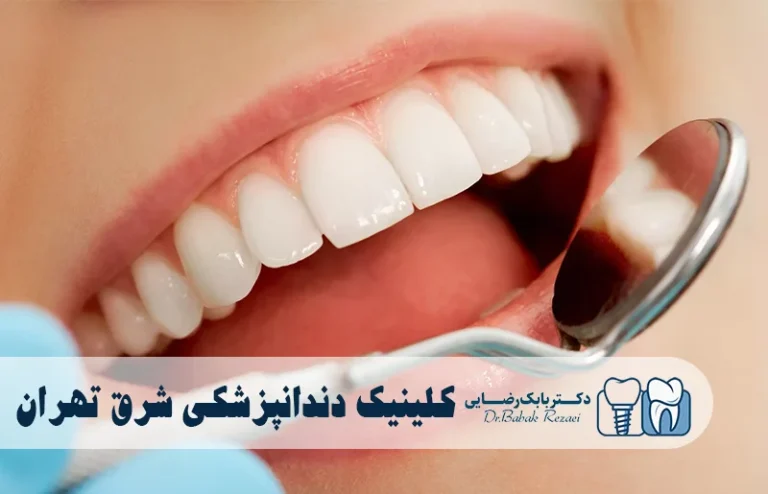 بهترین کلینیک دندانپزشکی شرق تهران