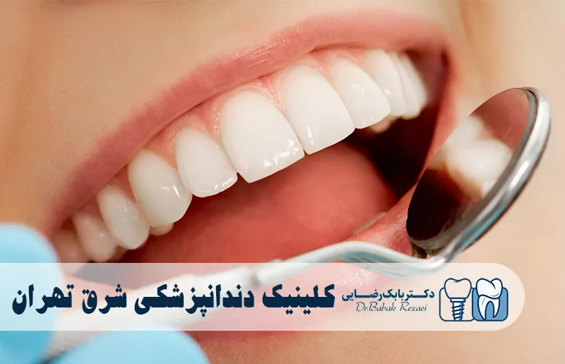 بهترین کلینیک دندانپزشکی شرق تهران