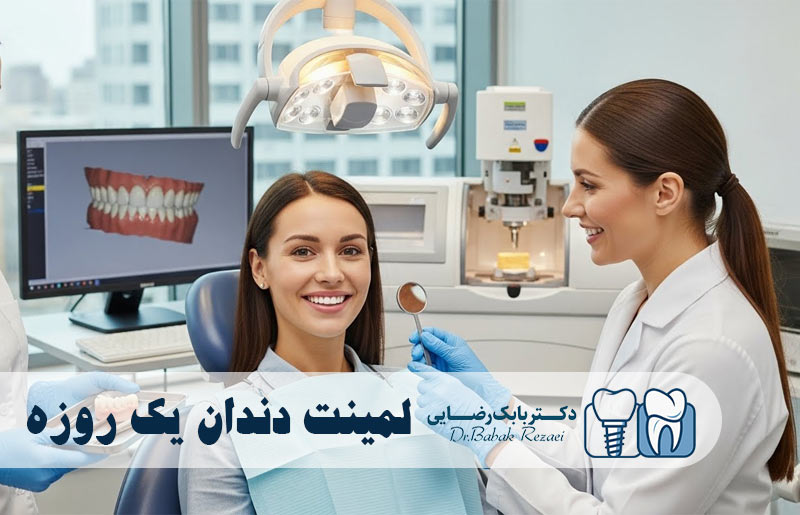 لمینت دندان یک روزه