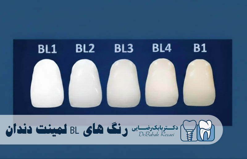 رنگ‌ های BL لمینت دندان