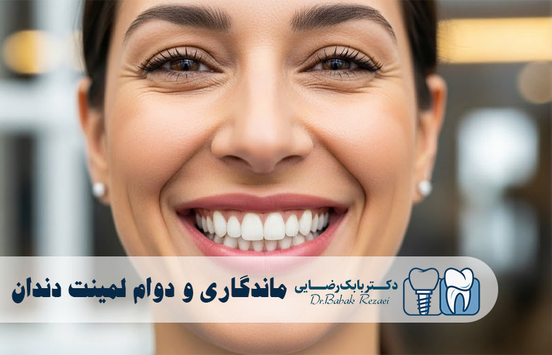 ماندگاری و دوام لمینت دندان