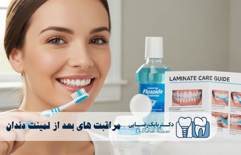 مراقبت های بعد از لمینت دندان