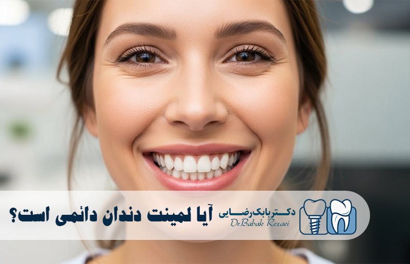 آیا لمینت دندان دائمی است؟